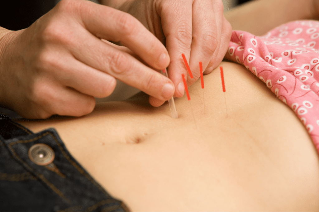 new affiliates fertility acupuncture