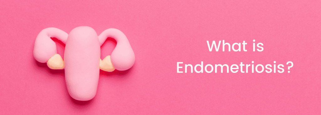 what is endometriosis